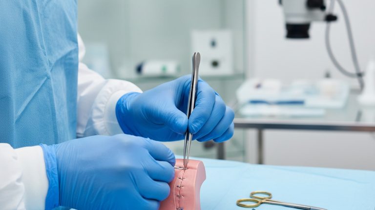 Suturas na Ninfoplastia: Técnicas Avançadas para uma Cicatrização Perfeita